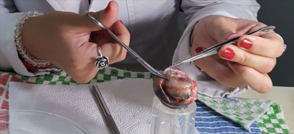 Podría utilizarse la presión intraocular como un indicador del tiempo de muerte